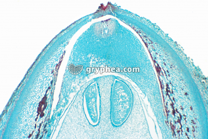 Pin - Ovule de Pin - Archégone CL x15 - gryphea.com